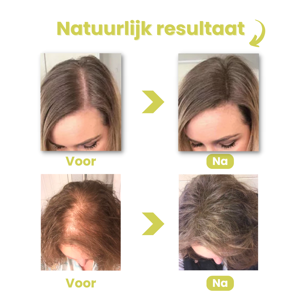 Cameaux natuurlijk resultaat